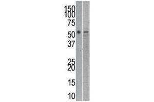 Reptin antibody used in western blot to detect RUVBL2 in mouse kidney (left) and SK-Br-3 (right) lysate (RUVBL2 Antikörper  (AA 400-430))