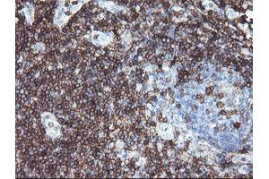Image no. 1 for anti-CD3 epsilon (CD3E) antibody (ABIN1497222)