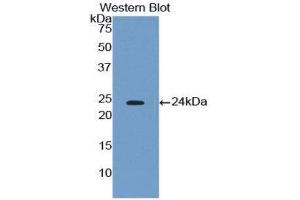Western Blotting (WB) image for anti-Phospholipase A2, Group IVA (Cytosolic, Calcium-Dependent) (PLA2G4A) (AA 563-749) antibody (ABIN1174847) (PLA2G4A Antikörper  (AA 563-749))