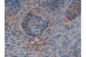 Immunohistochemistry (IHC) image for anti-Thrombospondin 1 (THBS1) (AA 24-221) antibody (ABIN7432184)