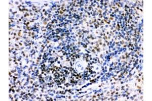 IHC testing of FFPE rat spleen with IKAROS antibody. (IKZF1 Antikörper)