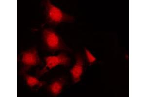 ABIN6267242 staining K562 by IF/ICC. (JAK2 Antikörper  (pTyr570))