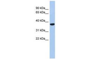 Image no. 1 for anti-Phosphatidic Acid Phosphatase Type 2 Domain Containing 2 (PPAPDC2) (N-Term) antibody (ABIN6743936)