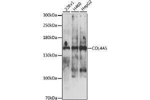 Western blot analysis of extracts of various cell lines, using COL4 antibody (ABIN6130196, ABIN6138845, ABIN6138846 and ABIN6225111) at 1:1000 dilution. (COL4a5 Antikörper  (AA 1462-1691))