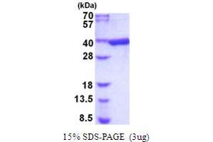 SDS-PAGE (SDS) image for Aldo-Keto Reductase Family 1, Member B1 (Aldose Reductase) (AKR1B1) (AA 1-316) (Active) protein (His tag) (ABIN5854099) (AKR1B1 Protein (AA 1-316) (His tag))
