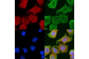 ABIN6258514 and ABIN6274732 staining Hela cells(45 min of heat-shock) by IF/ICC. (MRPL16 Antikörper  (Internal Region))