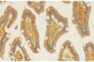 Immunohistochemistry of paraffin-embedded Human duodenum using ST14 Ployclonal Antibody at dilution of 1:200. (ST14 Antikörper)