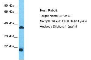 Host: Rabbit Target Name: SPDYE1 Sample Type: Fetal Heart lysates Antibody Dilution: 1. (SPDYE1 Antikörper  (N-Term))