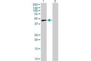 Western Blot analysis of TREX1 expression in transfected 293T cell line by TREX1 MaxPab polyclonal antibody. (TREX1 Antikörper  (AA 1-369))