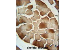 CFB Antibody immunohistochemistry analysis in formalin fixed and paraffin embedded human skeletal muscle followed by peroxidase conjugation of the secondary antibody and DAB staining. (Complement Factor B Antikörper  (AA 469-494))