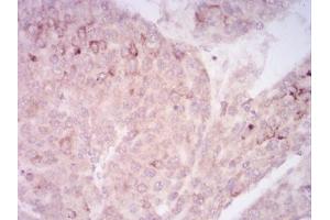 Immunohistochemistry (IHC) image for anti-Sirtuin 7 (SIRT7) (AA 1-105) antibody (ABIN5542445)