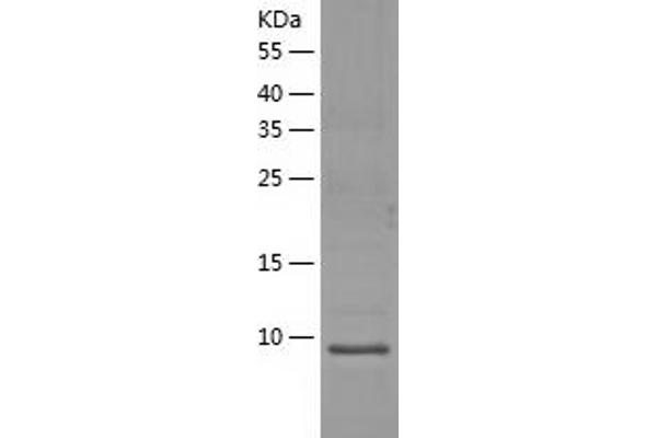 XCL1 Protein (AA 22-114) (His tag)