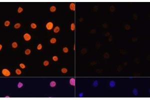 Immunofluorescence analysis of C6 cells using Acetyl-Histone H3-K4 Polyclonal Antibody at dilution of 1:100. (Histone 3 Antikörper  (acLys4))