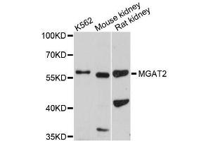 Western blot analysis of extracts of various cell lines, using MGAT2 antibody (ABIN5996502) at 1/1000 dilution. (MGAT2 Antikörper)