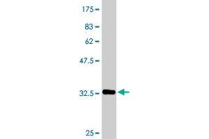 Western Blot detection against Immunogen (33. (SFRS6 Antikörper  (AA 1-75))