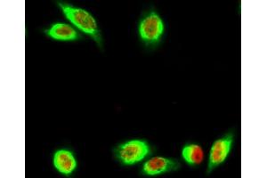 Immunofluorescence analysis of Hela cell. (Ki-67 Antikörper)