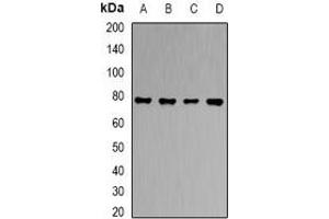 Western blot analysis of RBAT expression in HT29 (A), HepG2 (B), PC12 (C), mouse liver (D) whole cell lysates. (SLC3A1 Antikörper)
