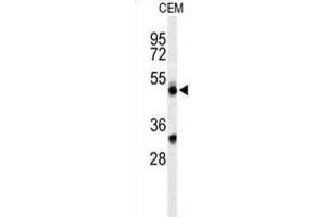 Western Blotting (WB) image for anti-Complement Factor P (CFP) antibody (ABIN3004386) (CFP Antikörper)