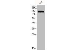 Western Blotting (WB) image for anti-Matrix Metallopeptidase 9 (Gelatinase B, 92kDa Gelatinase, 92kDa Type IV Collagenase) (MMP9) (C-Term) antibody (ABIN7185151)