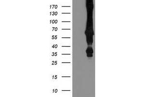 Western Blotting (WB) image for anti-Mahogunin, Ring Finger 1 (MGRN1) antibody (ABIN1499460) (Mahogunin RING Finger Protein 1 Antikörper)