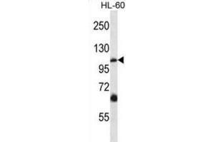 Western Blotting (WB) image for anti-Transient Receptor Potential Cation Channel, Subfamily C, Member 5 (TRPC5) antibody (ABIN2997528) (TRPC5 Antikörper)