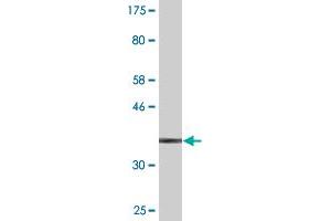 Western Blot detection against Immunogen (38. (S100A9 Antikörper  (AA 1-114))