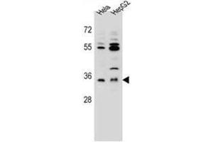 AKR1C3 Antibody (Center) western blot analysis in Hela,HepG2 cell line lysates (35ug/lane). (AKR1C3 Antikörper  (Middle Region))