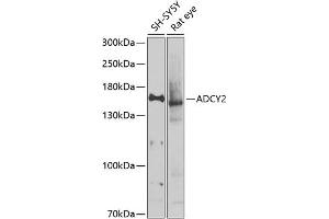 Western blot analysis of extracts of various cell lines, using  antibody (ABIN6129185, ABIN6136559, ABIN6136560 and ABIN6225105) at 1:1000 dilution. (ADCY2 Antikörper  (AA 430-600))