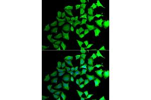 Immunofluorescence analysis of HeLa cells using TALDO1 antibody (ABIN5974092). (TALDO1 Antikörper)