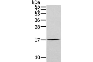 Gel: 12 % SDS-PAGE, Lysate: 40 μg, Lane: Human normal kidney tissue, Primary antibody: ABIN7193094(ZFAND2A Antibody) at dilution 1/300 dilution, Secondary antibody: Goat anti rabbit IgG at 1/8000 dilution, Exposure time: 2 minutes (ZFAND2A Antikörper)
