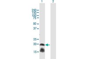 Western Blot analysis of IL1RN expression in transfected 293T cell line by IL1RN MaxPab polyclonal antibody. (IL1RN Antikörper  (AA 1-177))