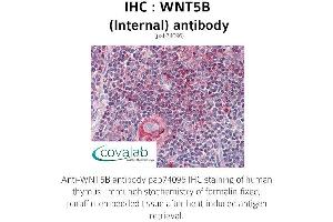 Image no. 1 for anti-Wingless-Type MMTV Integration Site Family, Member 5B (WNT5B) (Internal Region) antibody (ABIN1740832) (WNT5B Antikörper  (Internal Region))