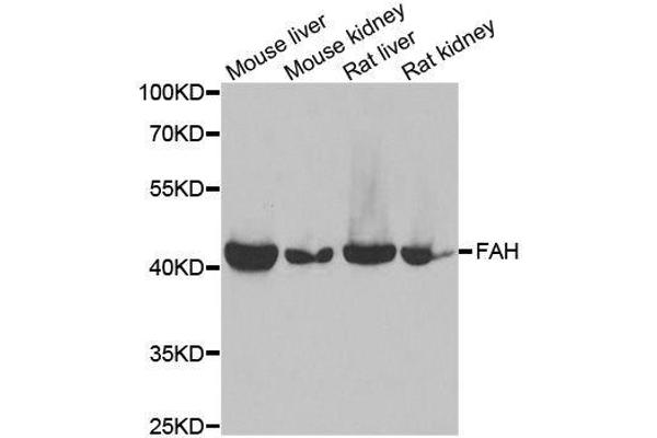 FAH Antikörper  (AA 1-419)