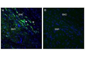 Expression of MCU in mouse midbrain. (MCU Antikörper  (Mitochondrial Matrix))