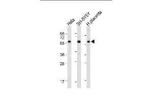 All lanes : Anti-BRD9 Antibody (N-term) at 1:1000-1:2000 dilution Lane 1: Hela whole cell lysate Lane 2: SH-SY5Y whole cell lysate Lane 3: Human placenta lysate Lysates/proteins at 20 μg per lane.