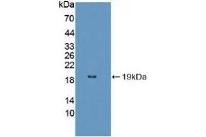 Detection of Recombinant FUM, Mouse using Polyclonal Antibody to Fumarase (FUM) (FH Antikörper  (AA 42-185))