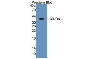 Western blot analysis of the recombinant protein. (CISH Antikörper  (AA 1-258))