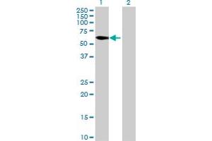 Western Blot analysis of C8orf45 expression in transfected 293T cell line by C8orf45 MaxPab polyclonal antibody. (C8orf45 Antikörper  (AA 1-585))