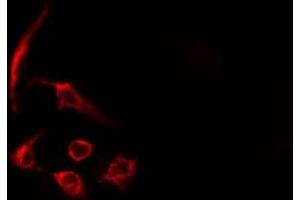 ABIN6275450 staining HeLa cells by IF/ICC. (RASA3 Antikörper  (Internal Region))