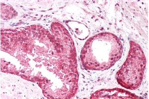 ABIN185725 (5µg/ml) staining of paraffin embedded Human Prostate. (PICK1 Antikörper  (Internal Region))