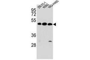 KREMEN2 Antibody (Center) western blot analysis in ZR-75-1,K562,NCI-H460 cell line lysates (35µg/lane). (KREMEN2 Antikörper  (Middle Region))