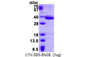 3-hydroxyanthranilate 3,4-Dioxygenase (HAAO) (AA 1-286) protein (His tag)
