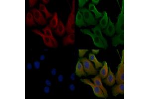 ABIN6257449 and ABIN6275470 staining Hela cells by IF/ICC. (Rab5c Antikörper  (Internal Region))