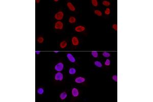 Confocal immunofluorescence analysis of U2OS cells using Ku70 Polyclonal Antibody (ABIN6134460, ABIN6150312, ABIN6150313 and ABIN6223171) at dilution of 1:100.