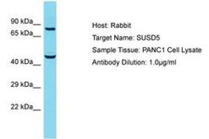 Image no. 1 for anti-Sushi Domain Containing 5 (SUSD5) (AA 304-353) antibody (ABIN6750594) (SUSD5 Antikörper  (AA 304-353))