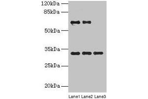Western blot All lanes: OTX2 antibody at 4 μg/mL Lane 1: Jurkat whole cell lysate Lane 2: Hela whole cell lysate Lane 3: Mouse lung tissue Secondary Goat polyclonal to rabbit IgG at 1/10000 dilution Predicted band size: 32, 33 kDa Observed band size: 32 kDa (OTX2 Antikörper  (AA 1-297))