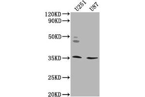 Western Blot Positive WB detected in: U251 whole cell lysate, U87 whole cell lysate All lanes: OR5K2 antibody at 1:2000 Secondary Goat polyclonal to rabbit IgG at 1/50000 dilution Predicted band size: 36 kDa Observed band size: 36 kDa (OR5K2 Antikörper  (AA 6-24))