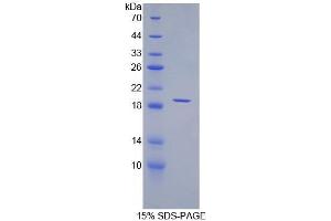 SDS-PAGE of Protein Standard from the Kit (Highly purified E. (Angiopoietin 1 CLIA Kit)