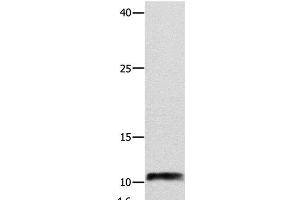 Western Blot analysis of Hela cell using NPY Polyclonal Antibody at dilution of 1:250 (NPY Antikörper)