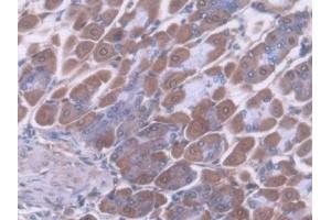 Detection of ALDH1A1 in Mouse Stomach Tissue using Polyclonal Antibody to Aldehyde Dehydrogenase 1 Family, Member A1 (ALDH1A1) (ALDH1A1 Antikörper  (AA 1-326))